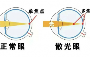 散光眼镜晚上带怎么样，散光眼镜戴久了会有什么影响